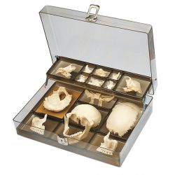 Ontplofte schedel van volwassene, 22-delig 2