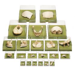 Ontplofte schedel van volwassene, 22-delig, in opbergdozen