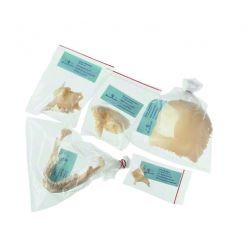 Ontplofte schedel van volwassene, 22-dlg, in plastik zakjes