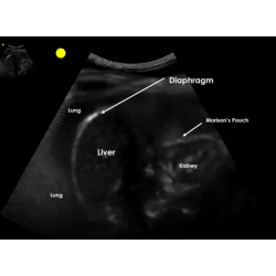 E-Learning Point-of-Care Ultrasound 