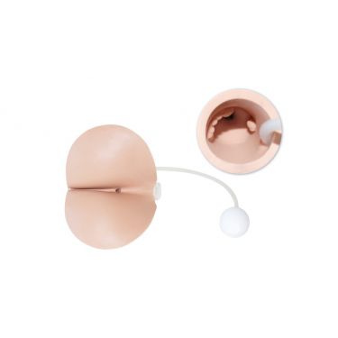 Perineum Pathologie