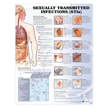 Wandplaat 'Sexually Transmitted Diseases'