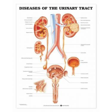 Wandplaat 'Diseases of the Urinary Tract'