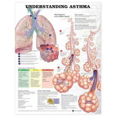 Wandplaat 'Understanding Asthma'