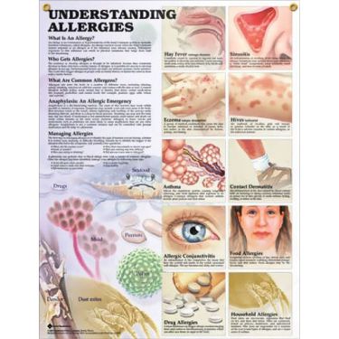 Wandplaat 'Understanding Allergies'