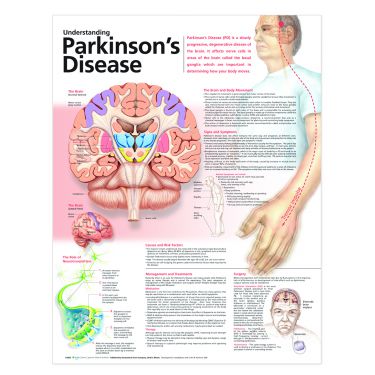 Wandplaat 'Understanding Parkinson's Disease'