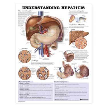 Wandplaat 'Understanding Hepatitis'