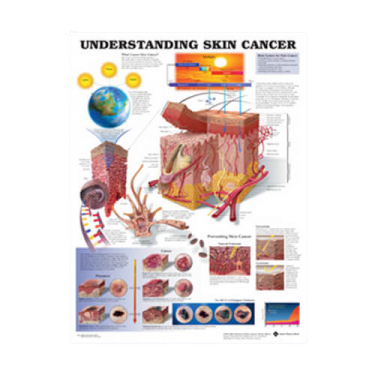 Wandplaat 'Understanding Skin Cancer' 