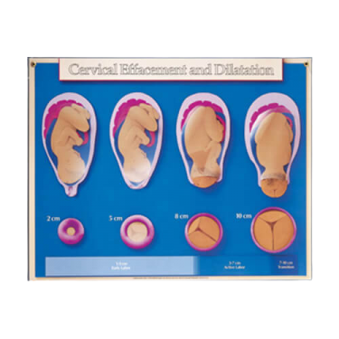 Set van 6 wandplaten, zwangerschap en geboorte 