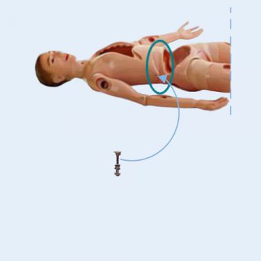 Schroefverbinding voor taillegewricht, enkele set