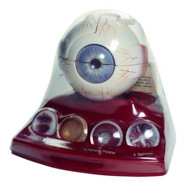 Demonstratiemodel van oog met staar, 3x vergroot, 9-delig