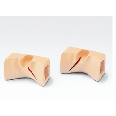 Perineal suture model (with left and right laceration model)