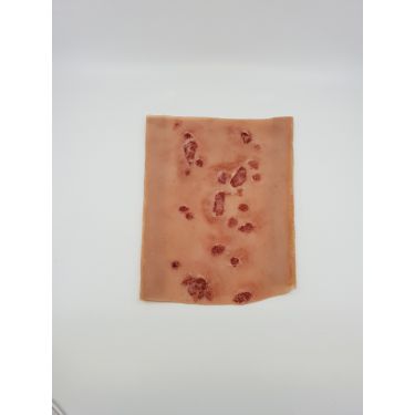 Wond "Diabetes sores on leg" sleeve