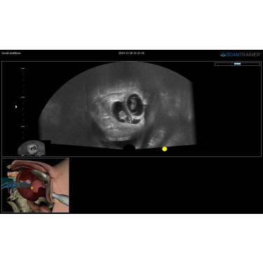 ScanTrainer "TVS/TAS-OBGYN - Module 8 – Transvaginal/Transabdominal Ultrasound Learning Package" – voor ScanTrainer of ScanTrainer Compact