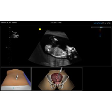 ScanTrainer "TAS-OBGYN - Module 3 – Transabdominal Ultrasound Learning Package" – voor ScanTrainer of ScanTrainer Compact