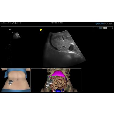 ScanTrainer TAS Emergency - Module 4 – Abdominal Ultrasound Emergency Learning Package – voor ScanTrainer of ScanTrainer Compact