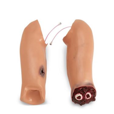 Traumasleeve bovenarm Rescue Randy