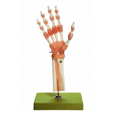 Funktiemodel van de hand- en vingergewrichten