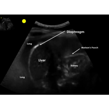 E-Learning Point-of-Care Ultrasound 